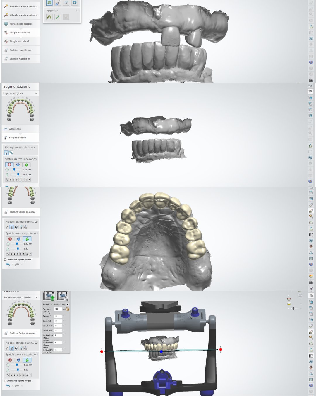 Progettazione CAD anatomica
